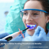 All About Dental Bonding: Procedure and Benefits