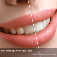 How Smoking Affects Your Teeth