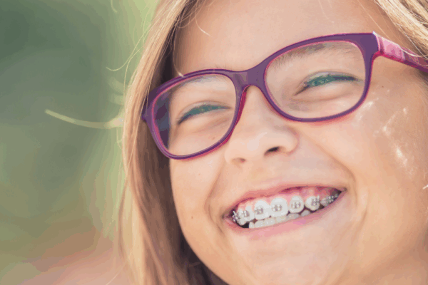 Alternatives to Traditional Braces