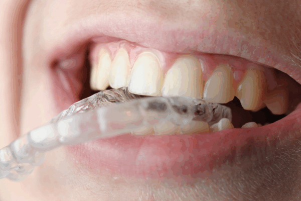 Are Dental Chews Good for Oral Health?