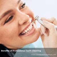 Benefits of Professional Teeth Cleaning
