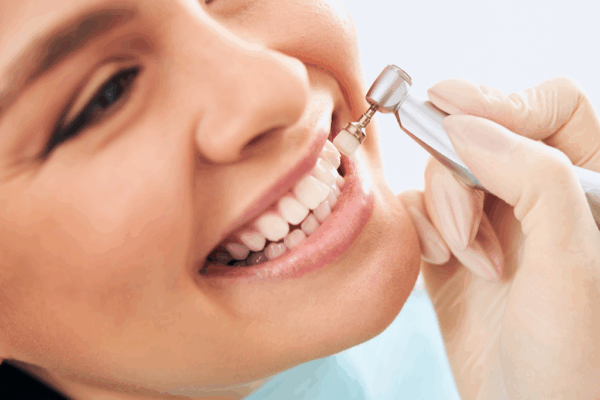 Benefits of Professional Teeth Cleaning