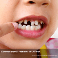 Common Dental Problems in Children