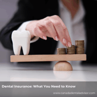Dental Insurance: What You Need to Know