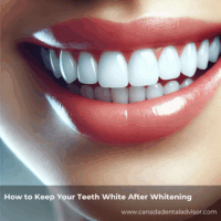How to Keep Your Teeth White After Whitening