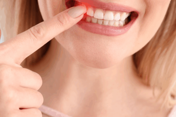 How to Prevent Gum Disease