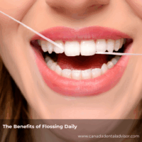 The Benefits of Flossing Daily