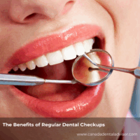The Benefits of Regular Dental Checkups