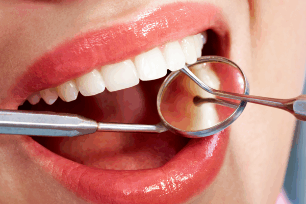 The Benefits of Regular Dental Checkups