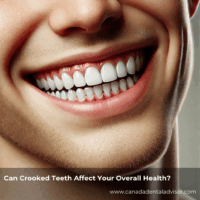 Can Crooked Teeth Affect Your Overall Health?