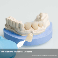 Innovations in Dental Veneers: Materials and Techniques