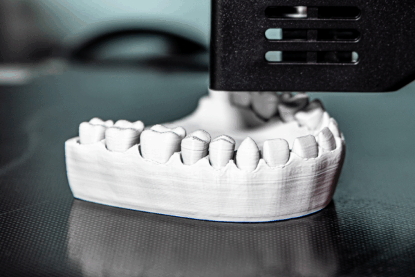 The Benefits of 3D Printing in Dentistry