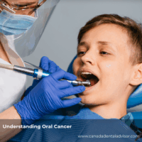 Understanding Oral Cancer: Screening, Risks, and Prevention