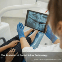 The Evolution of Dental X-Ray Technology: Safety and Accuracy