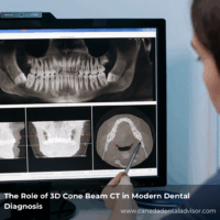 The Role of 3D Cone Beam CT in Modern Dental Diagnosis