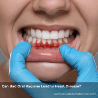 Can Bad Oral Hygiene Lead to Heart Disease?