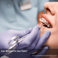 Can Braces Fix Jaw Pain?