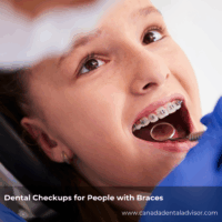 Dental Checkups for People with Braces: What’s Different?