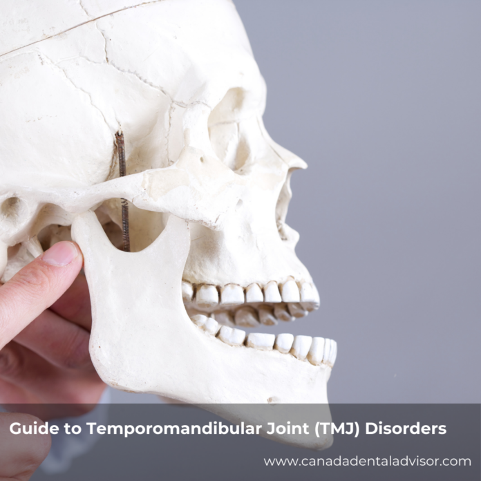 Guide to Temporomandibular Joint (TMJ) Disorders