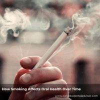 How Smoking Affects Oral Health Over Time
