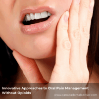 Innovative Approaches to Oral Pain Management Without Opioids