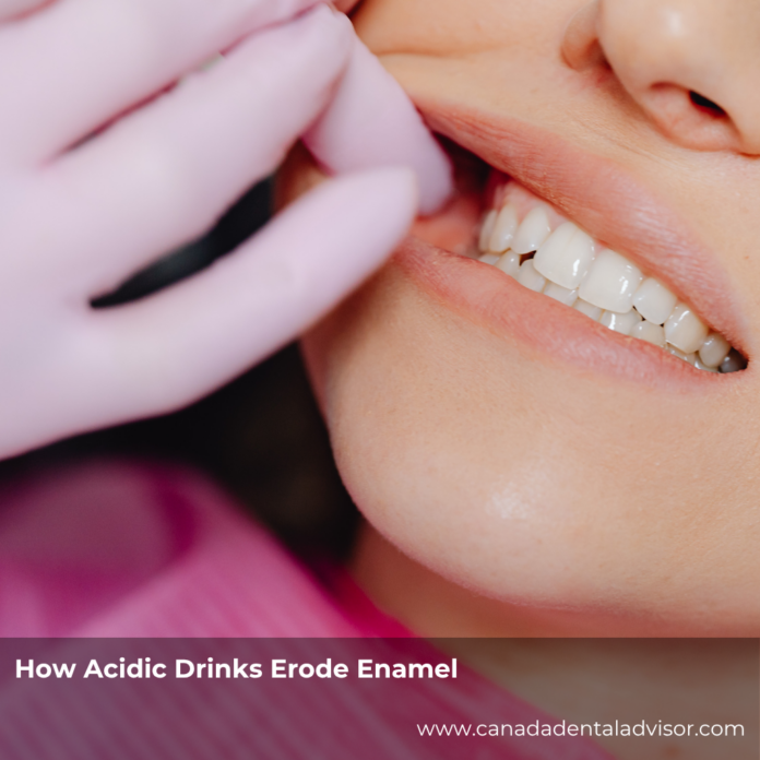 How Acidic Drinks Erode Enamel