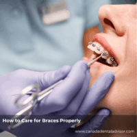 How to Care for Braces Properly