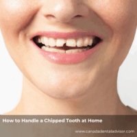 How to Handle a Chipped Tooth at Home