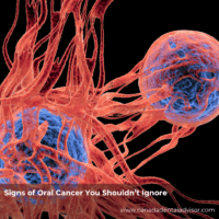 Signs of Oral Cancer You Shouldn’t Ignore