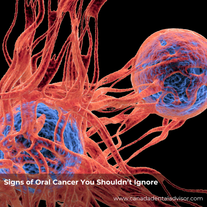 Signs of Oral Cancer You Shouldn’t Ignore