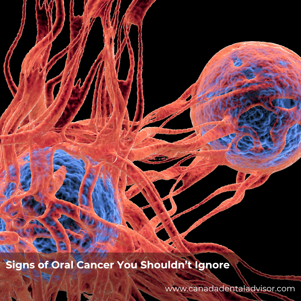 Signs of Oral Cancer You Shouldn’t Ignore
