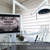 The Importance of Dental X-Rays