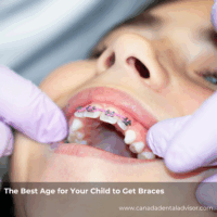 The Best Age for Your Child to Get Braces