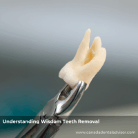 Understanding Wisdom Teeth Removal