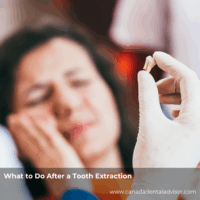 What to Do After a Tooth Extraction