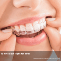 Is Invisalign Right for You?