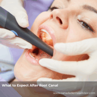 What to Expect After Root Canal