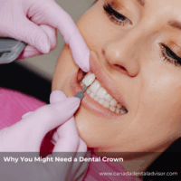 Why You Might Need a Dental Crown