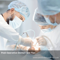 Post-Operative Dental Care Tips
