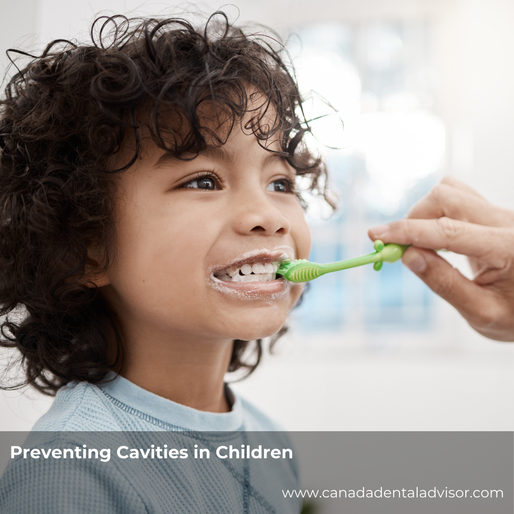 Preventing Cavities in Children