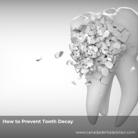 How to Prevent Tooth Decay