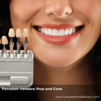 Porcelain Veneers: Pros and Cons
