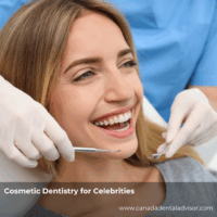 Cosmetic Dentistry for Celebrities