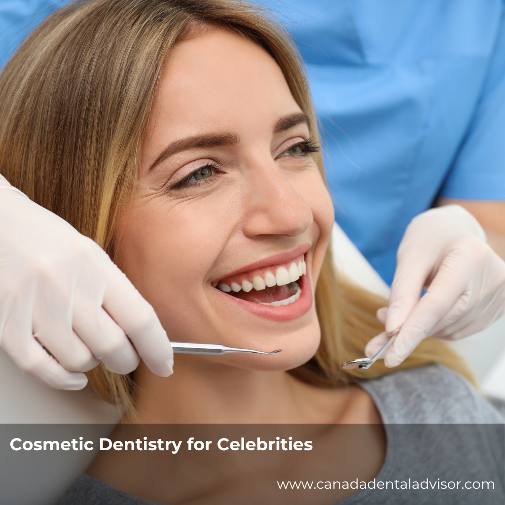 Cosmetic Dentistry for Celebrities