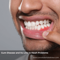 Gum Disease and Its Link to Heart Problems