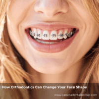 How Orthodontics Can Change Your Face Shape
