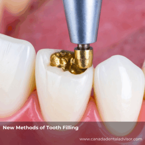 New Methods of Tooth Filling