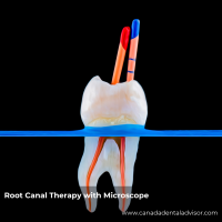 Root Canal Therapy with Microscope