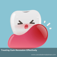 Treating Gum Recession Effectively