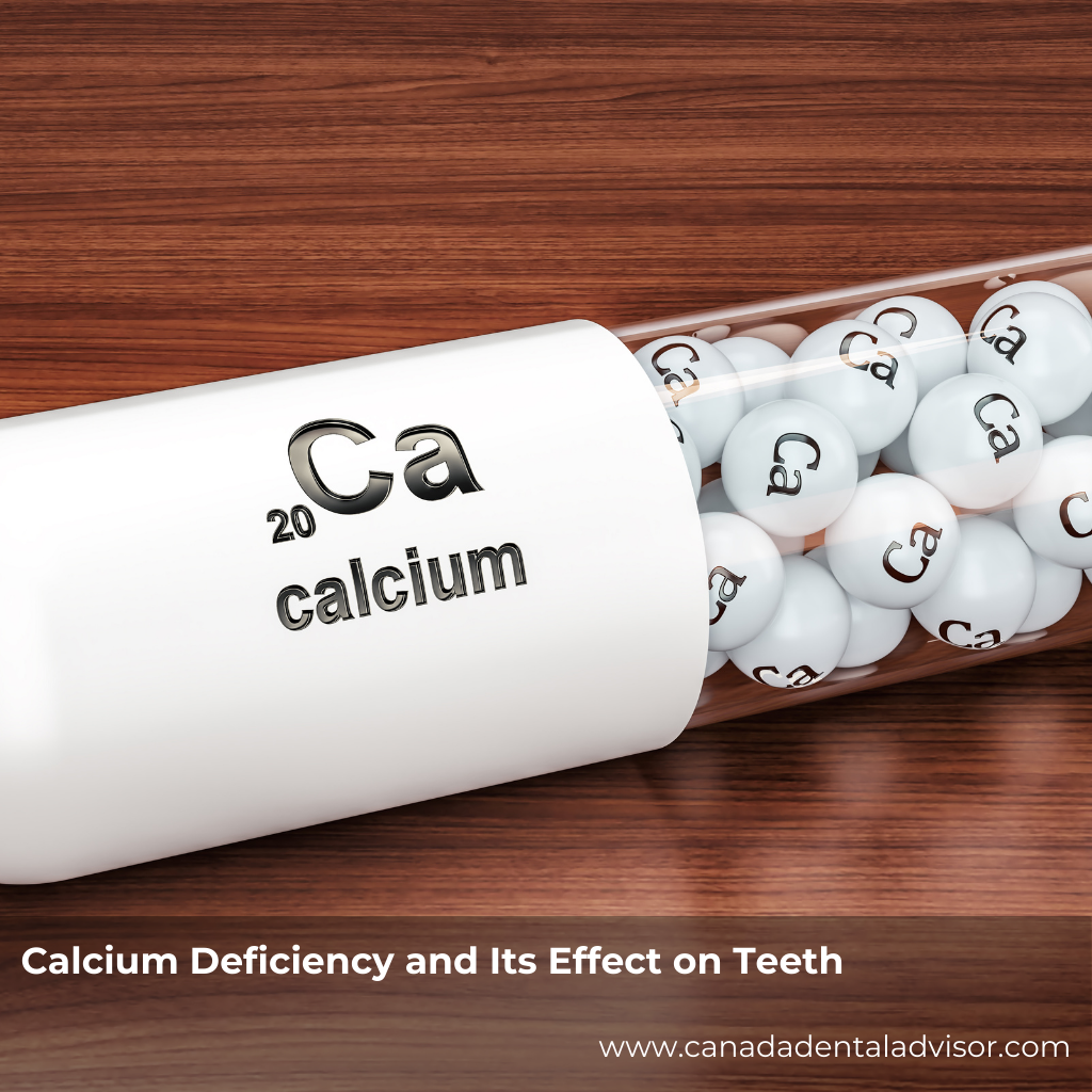 Calcium Deficiency and Its Effect on Teeth